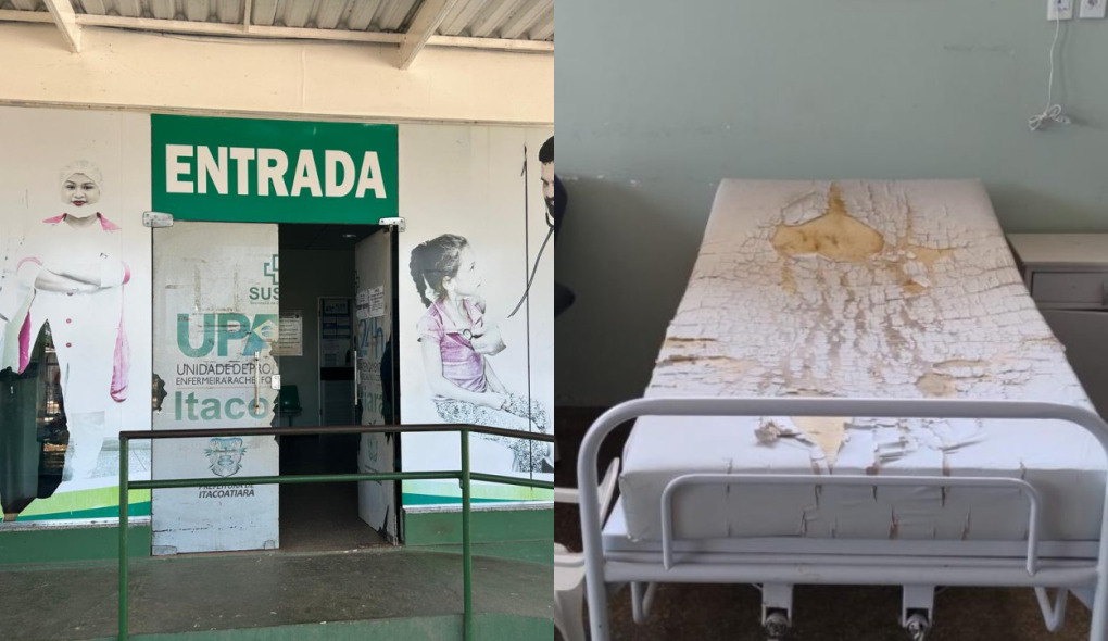 Sem ambulância, UPA de Itacoatiara vira alvo de investigação por estado ‘precário’